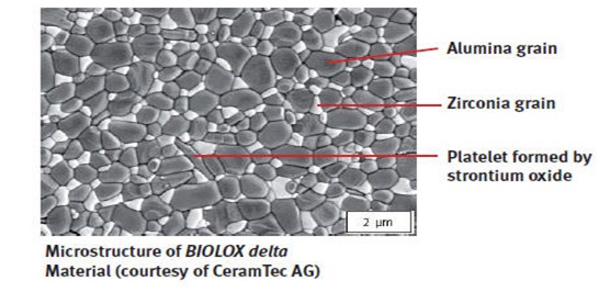Şekil 2: Alumina Matrisli Stronyum Oksit-Zirkonya Mikroyapısı         